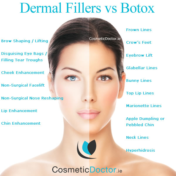 Dermal Fillers vs Botox | Cosmetic Doctor Dublin