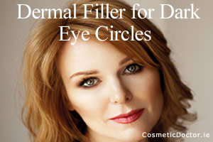 Dermal Fillers and Dark Eye Circles