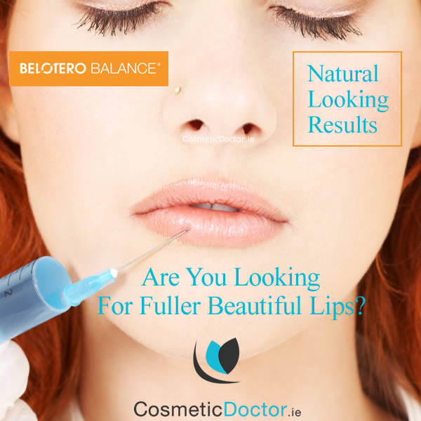 Fuller Lips with Belotero Dermal Filler
